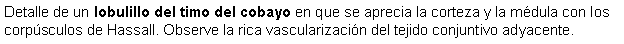 Cuadro de texto: Detalle de un lobulillo del timo del cobayo en que se aprecia la corteza y la mdula con los corpsculos de Hassall. Observe la rica vascularizacin del tejido conjuntivo adyacente.