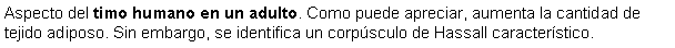 Cuadro de texto: Aspecto del timo humano en un adulto. Como puede apreciar, aumenta la cantidad de tejido adiposo. Sin embargo, se identifica un corpsculo de Hassall caracterstico.