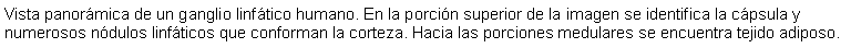 Cuadro de texto: Vista panormica de un ganglio linftico humano. En la porcin superior de la imagen se identifica la cpsula y numerosos ndulos linfticos que conforman la corteza. Hacia las porciones medulares se encuentra tejido adiposo.