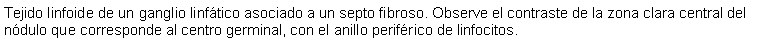 Cuadro de texto: Tejido linfoide de un ganglio linftico asociado a un septo fibroso. Observe el contraste de la zona clara central del ndulo que corresponde al centro germinal, con el anillo perifrico de linfocitos.