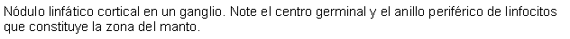 Cuadro de texto: Ndulo linftico cortical en un ganglio. Note el centro germinal y el anillo perifrico de linfocitos que constituye la zona del manto.