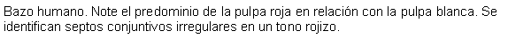 Cuadro de texto: Bazo humano. Note el predominio de la pulpa roja en relacin con la pulpa blanca. Se identifican septos conjuntivos irregulares en un tono rojizo.