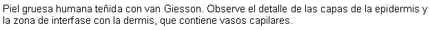 Cuadro de texto: Piel gruesa humana teida con van Giesson. Observe el detalle de las capas de la epidermis y la zona de interfase con la dermis, que contiene vasos capilares.