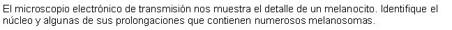 Cuadro de texto: El microscopio electrnico de transmisin nos muestra el detalle de un melanocito. Identifique el ncleo y algunas de sus prolongaciones que contienen numerosos melanosomas.