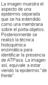 Cuadro de texto: La imagen muestra el aspecto de una epidermis separada que se ha extendido como una membrana sobre el porta-objetos. Posteriormente se realiz la tcnica histoqumica enzimtica para identificar la presencia de ATPasa. La imagen as, equivale a estar viendo la epidermis de frente.