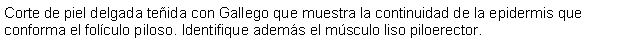 Cuadro de texto: Corte de piel delgada teida con Gallego que muestra la continuidad de la epidermis que conforma el folculo piloso. Identifique adems el msculo liso piloerector.