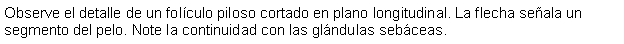 Cuadro de texto: Observe el detalle de un folculo piloso cortado en plano longitudinal. La flecha seala un segmento del pelo. Note la continuidad con las glndulas sebceas.