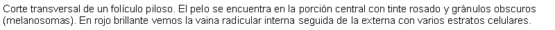 Cuadro de texto: Corte transversal de un folculo piloso. El pelo se encuentra en la porcin central con tinte rosado y grnulos obscuros (melanosomas). En rojo brillante vemos la vaina radicular interna seguida de la externa con varios estratos celulares.