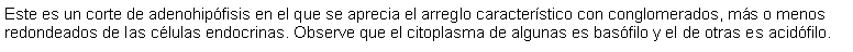 Cuadro de texto: Este es un corte de adenohipfisis en el que se aprecia el arreglo caracterstico con conglomerados, ms o menos redondeados de las clulas endocrinas. Observe que el citoplasma de algunas es basfilo y el de otras es acidfilo.