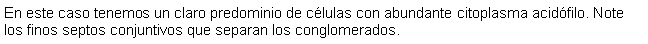 Cuadro de texto: En este caso tenemos un claro predominio de clulas con abundante citoplasma acidfilo. Note los finos septos conjuntivos que separan los conglomerados. 