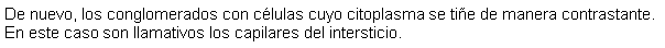 Cuadro de texto: De nuevo, los conglomerados con clulas cuyo citoplasma se tie de manera contrastante. En este caso son llamativos los capilares del intersticio.