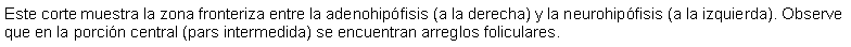Cuadro de texto: Este corte muestra la zona fronteriza entre la adenohipfisis (a la derecha) y la neurohipfisis (a la izquierda). Observe que en la porcin central (pars intermedida) se encuentran arreglos foliculares.