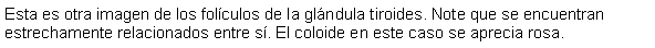 Cuadro de texto: Esta es otra imagen de los folculos de la glndula tiroides. Note que se encuentran estrechamente relacionados entre s. El coloide en este caso se aprecia rosa.