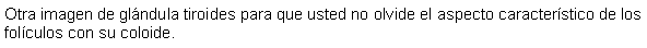 Cuadro de texto: Otra imagen de glndula tiroides para que usted no olvide el aspecto caracterstico de los folculos con su coloide.