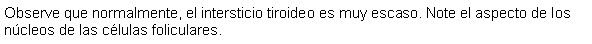 Cuadro de texto: Observe que normalmente, el intersticio tiroideo es muy escaso. Note el aspecto de los ncleos de las clulas foliculares.