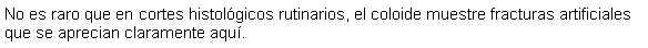 Cuadro de texto: No es raro que en cortes histolgicos rutinarios, el coloide muestre fracturas artificiales que se aprecian claramente aqu. 