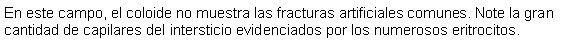 Cuadro de texto: En este campo, el coloide no muestra las fracturas artificiales comunes. Note la gran cantidad de capilares del intersticio evidenciados por los numerosos eritrocitos.