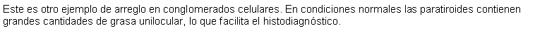 Cuadro de texto: Este es otro ejemplo de arreglo en conglomerados celulares. En condiciones normales las paratiroides contienen grandes cantidades de grasa unilocular, lo que facilita el histodiagnstico.