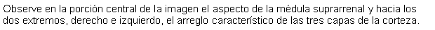 Cuadro de texto: Observe en la porcin central de la imagen el aspecto de la mdula suprarrenal y hacia los dos extremos, derecho e izquierdo, el arreglo caracterstico de las tres capas de la corteza.