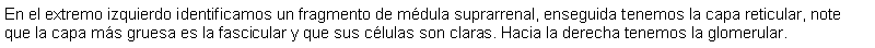 Cuadro de texto: En el extremo izquierdo identificamos un fragmento de mdula suprarrenal, enseguida tenemos la capa reticular, note que la capa ms gruesa es la fascicular y que sus clulas son claras. Hacia la derecha tenemos la glomerular.