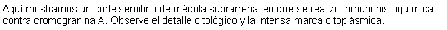 Cuadro de texto: Aqu mostramos un corte semifino de mdula suprarrenal en que se realiz inmunohistoqumica contra cromogranina A. Observe el detalle citolgico y la intensa marca citoplsmica.