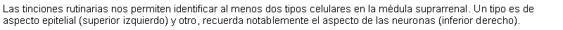 Cuadro de texto: Las tinciones rutinarias nos permiten identificar al menos dos tipos celulares en la mdula suprarrenal. Un tipo es de aspecto epitelial (superior izquierdo) y otro, recuerda notablemente el aspecto de las neuronas (inferior derecho).