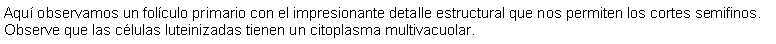 Cuadro de texto: Aqu observamos un folculo primario con el impresionante detalle estructural que nos permiten los cortes semifinos. Observe que las clulas luteinizadas tienen un citoplasma multivacuolar.