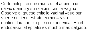 Cuadro de texto: Corte holptico que muestra el aspecto del crvix uterino y su relacin con la vagina. Observe el grueso epitelio vaginal que por suerte no tiene estrato crneo y su continuidad con el epitelio exocervical. En el endocrvix, el epitelio es mucho ms delgado.