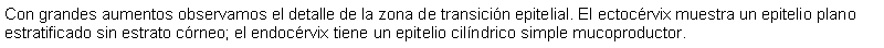 Cuadro de texto: Con grandes aumentos observamos el detalle de la zona de transicin epitelial. El ectocrvix muestra un epitelio plano estratificado sin estrato crneo; el endocrvix tiene un epitelio cilndrico simple mucoproductor.