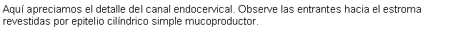 Cuadro de texto: Aqu apreciamos el detalle del canal endocervical. Observe las entrantes hacia el estroma revestidas por epitelio cilndrico simple mucoproductor.