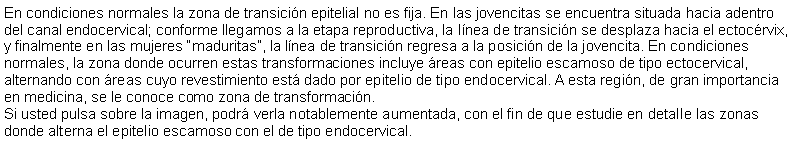 Cuadro de texto: En condiciones normales la zona de transicin epitelial no es fija. En las jovencitas se encuentra situada hacia adentro del canal endocervical; conforme llegamos a la etapa reproductiva, la lnea de transicin se desplaza hacia el ectocrvix, y finalmente en las mujeres maduritas, la lnea de transicin regresa a la posicin de la jovencita. En condiciones normales, la zona donde ocurren estas transformaciones incluye reas con epitelio escamoso de tipo ectocervical, alternando con reas cuyo revestimiento est dado por epitelio de tipo endocervical. A esta regin, de gran importancia en medicina, se le conoce como zona de transformacin. Si usted pulsa sobre la imagen, podr verla notablemente aumentada, con el fin de que estudie en detalle las zonas donde alterna el epitelio escamoso con el de tipo endocervical.