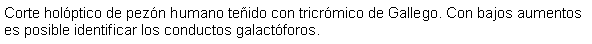 Cuadro de texto: Corte holptico de pezn humano teido con tricrmico de Gallego. Con bajos aumentos es posible identificar los conductos galactforos.