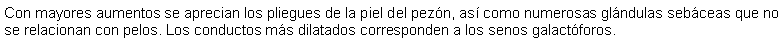 Cuadro de texto: Con mayores aumentos se aprecian los pliegues de la piel del pezn, as como numerosas glndulas sebceas que no se relacionan con pelos. Los conductos ms dilatados corresponden a los senos galactforos.