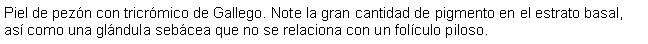 Cuadro de texto: Piel de pezn con tricrmico de Gallego. Note la gran cantidad de pigmento en el estrato basal, as como una glndula sebcea que no se relaciona con un folculo piloso.