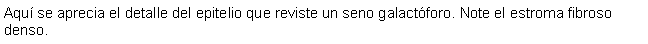 Cuadro de texto: Aqu se aprecia el detalle del epitelio que reviste un seno galactforo. Note el estroma fibroso denso.