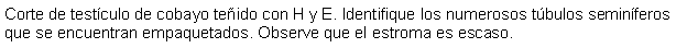 Cuadro de texto: Corte de testculo de cobayo teido con H y E. Identifique los numerosos tbulos seminferos que se encuentran empaquetados. Observe que el estroma es escaso.