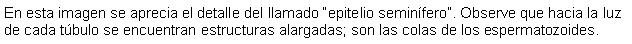 Cuadro de texto: En esta imagen se aprecia el detalle del llamado epitelio seminfero. Observe que hacia la luz de cada tbulo se encuentran estructuras alargadas; son las colas de los espermatozoides.