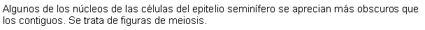 Cuadro de texto: Algunos de los ncleos de las clulas del epitelio seminfero se aprecian ms obscuros que los contiguos. Se trata de figuras de meiosis.