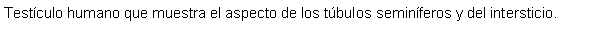 Cuadro de texto: Testculo humano que muestra el aspecto de los tbulos seminferos y del intersticio.