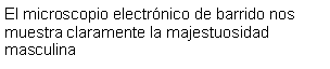 Cuadro de texto: El microscopio electrnico de barrido nos muestra claramente la majestuosidad masculina