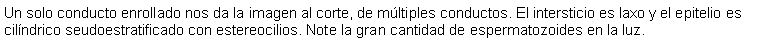 Cuadro de texto: Un solo conducto enrollado nos da la imagen al corte, de mltiples conductos. El intersticio es laxo y el epitelio es cilndrico seudoestratificado con estereocilios. Note la gran cantidad de espermatozoides en la luz.