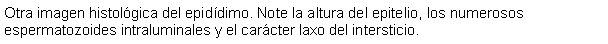 Cuadro de texto: Otra imagen histolgica del epiddimo. Note la altura del epitelio, los numerosos espermatozoides intraluminales y el carcter laxo del intersticio.