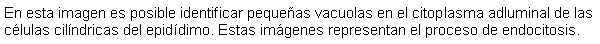 Cuadro de texto: En esta imagen es posible identificar pequeas vacuolas en el citoplasma adluminal de las clulas cilndricas del epiddimo. Estas imgenes representan el proceso de endocitosis.