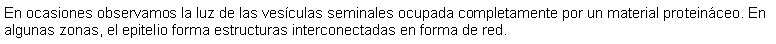 Cuadro de texto: En ocasiones observamos la luz de las vesculas seminales ocupada completamente por un material proteinceo. En algunas zonas, el epitelio forma estructuras interconectadas en forma de red.