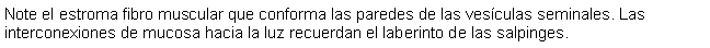 Cuadro de texto: Note el estroma fibro muscular que conforma las paredes de las vesculas seminales. Las interconexiones de mucosa hacia la luz recuerdan el laberinto de las salpinges.