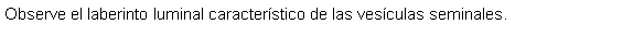 Cuadro de texto: Observe el laberinto luminal caracterstico de las vesculas seminales. 