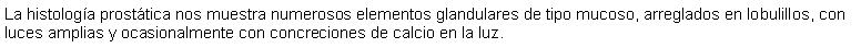 Cuadro de texto: La histologa prosttica nos muestra numerosos elementos glandulares de tipo mucoso, arreglados en lobulillos, con luces amplias y ocasionalmente con concreciones de calcio en la luz.