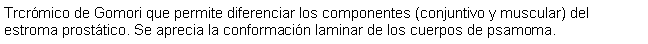 Cuadro de texto: Trcrmico de Gomori que permite diferenciar los componentes (conjuntivo y muscular) del estroma prosttico. Se aprecia la conformacin laminar de los cuerpos de psamoma.