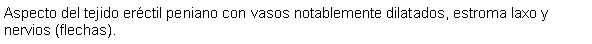 Cuadro de texto: Aspecto del tejido erctil peniano con vasos notablemente dilatados, estroma laxo y nervios (flechas).