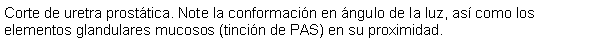 Cuadro de texto: Corte de uretra prosttica. Note la conformacin en ngulo de la luz, as como los elementos glandulares mucosos (tincin de PAS) en su proximidad.